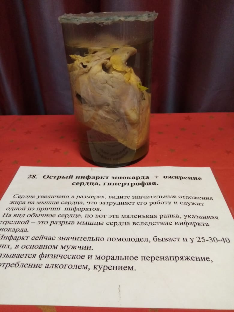 Сердечная мышца