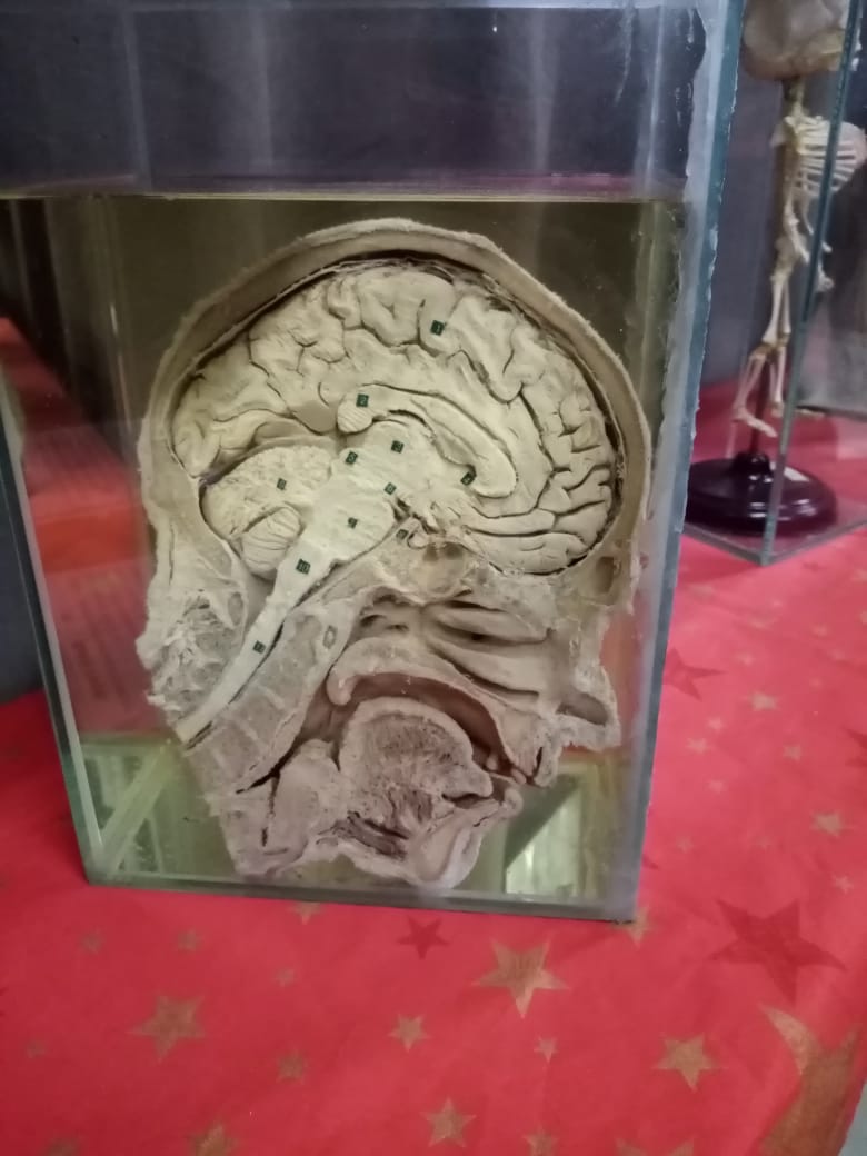 Мозг человека